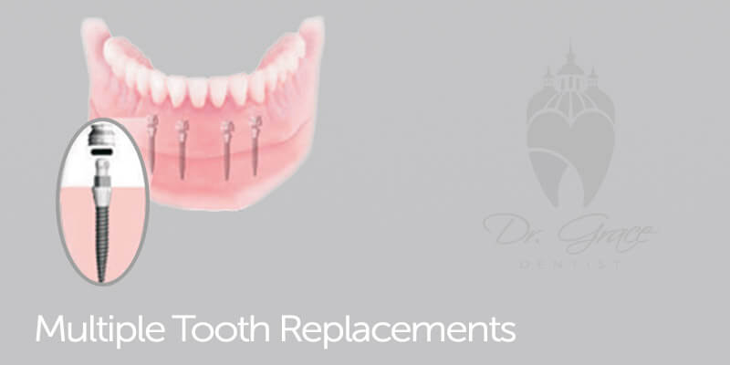 Restorative & Prosthetic Dentistry 2