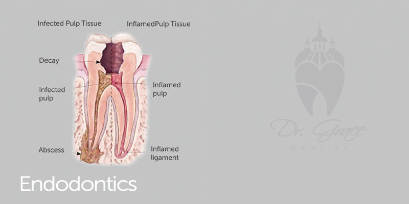 Endodontics 3